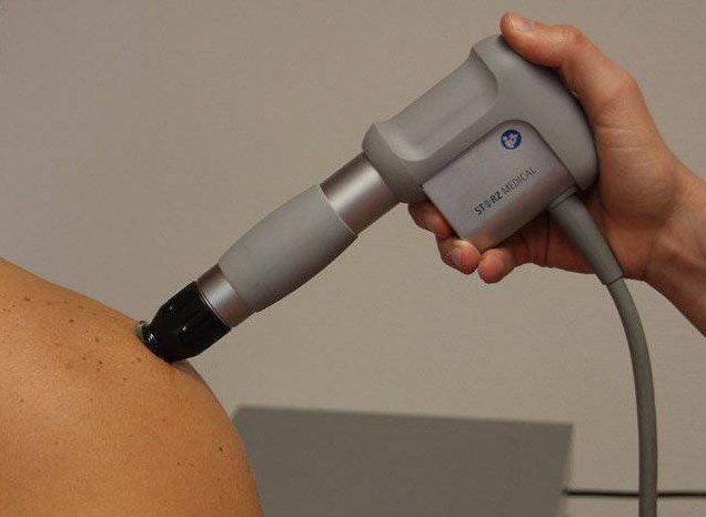 Shockwave therapie